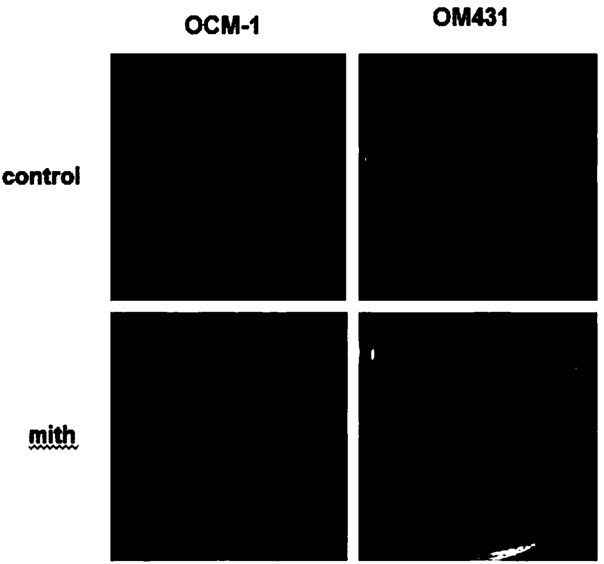An application of a transcription factor Spl specific inhibitor in preparation of medicines treating uveal melanoma