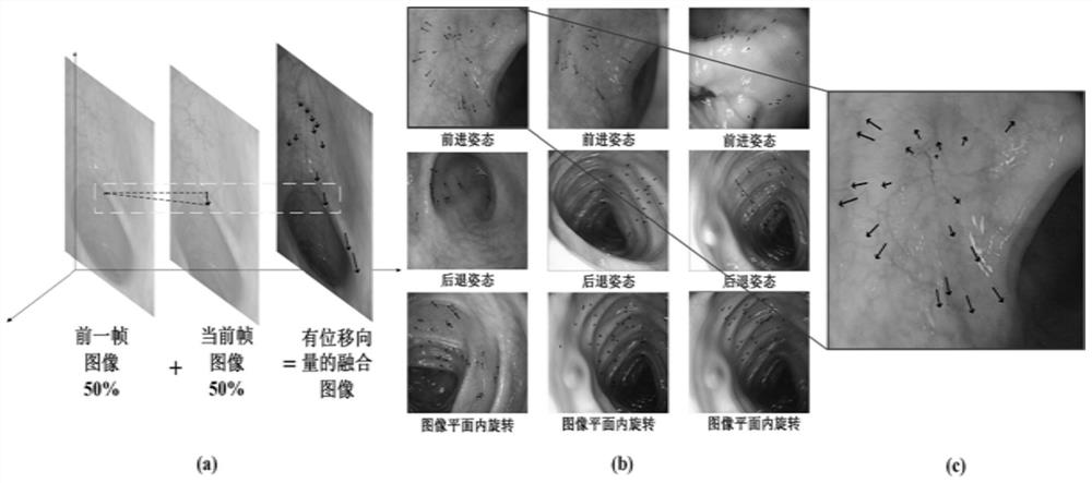 Digestive endoscopy navigation method and system