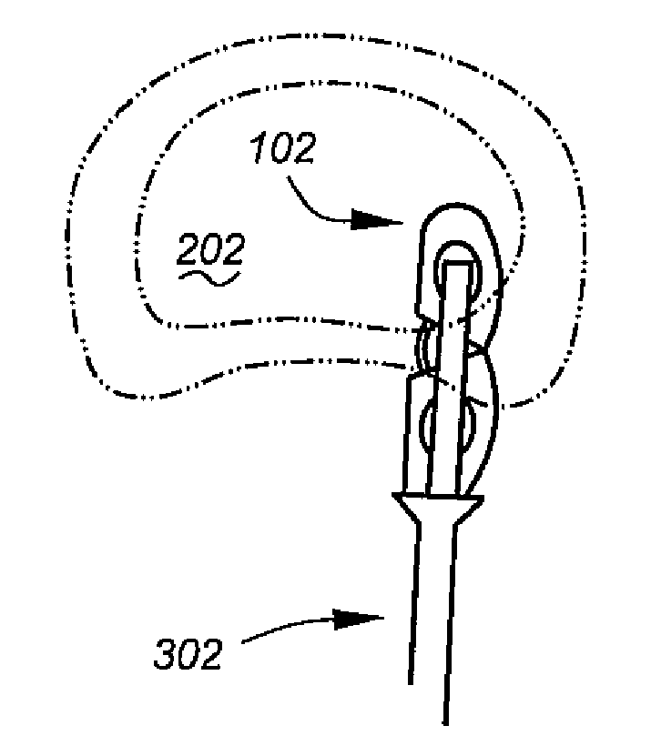 Steerable interbody fusion cage