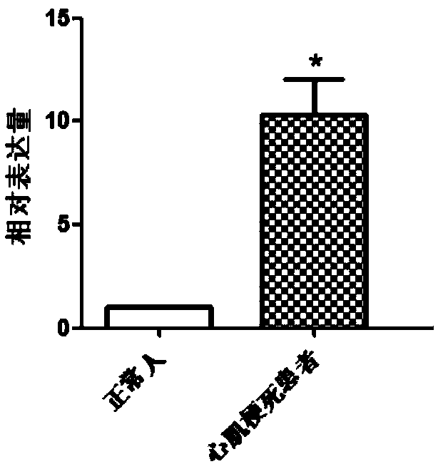 Application of RAE 1 gene or protein as biomarker for diagnosing myocardial infarction