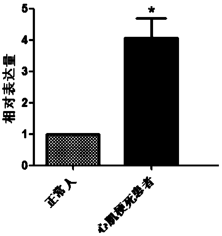 Application of RAE 1 gene or protein as biomarker for diagnosing myocardial infarction