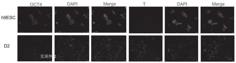 Method for inducing and differentiating human embryonic stem cells into mesenchymal stem cells