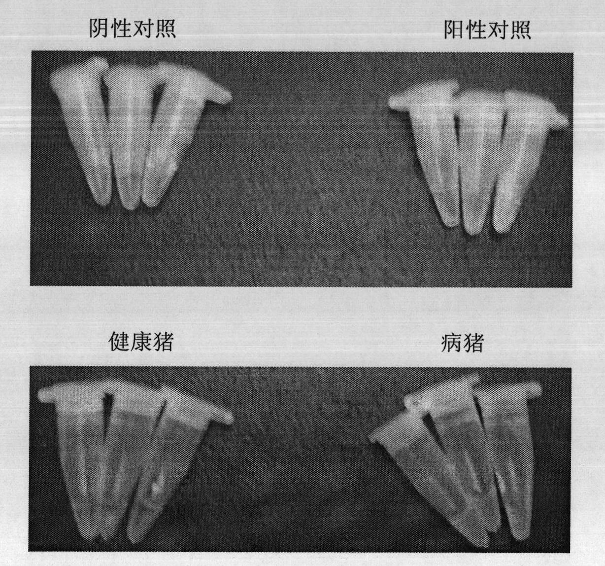 Toxoplasma gondii detection kit and application thereof