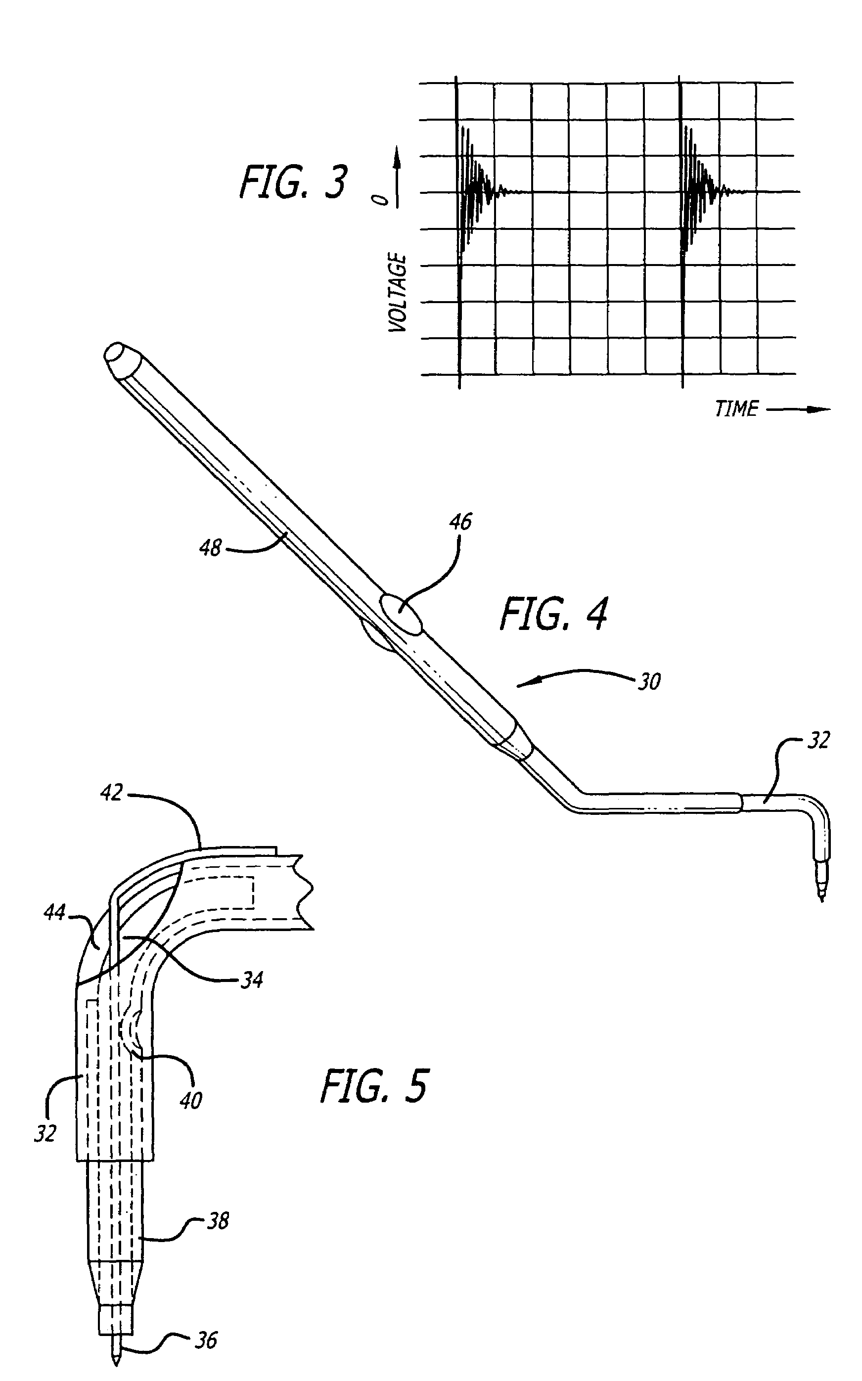 Electrode assembly for a thermokeratoplasty system used to correct vision acuity