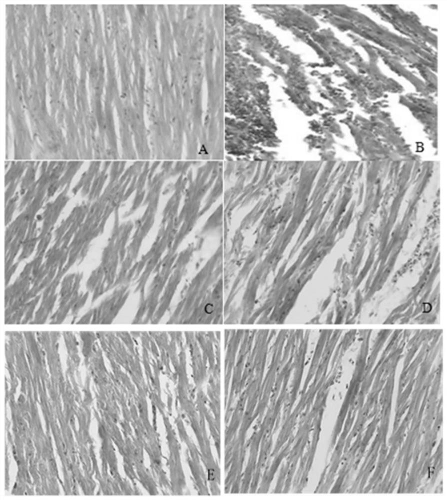 A traditional Chinese medicine extract for alleviating heat stress damage to broiler myocardium and preparation method thereof