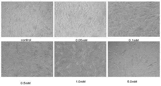 Application of dencichine in preparation of medicament for treating neurodegenerative diseases