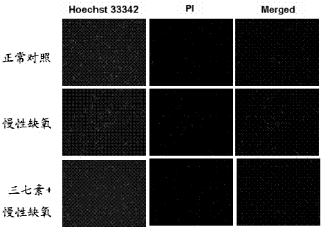 Application of dencichine in preparation of medicament for treating neurodegenerative diseases