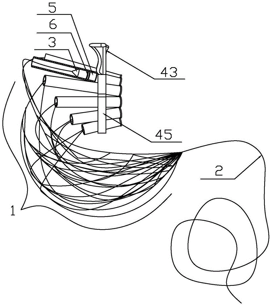 Novel casting fishing net