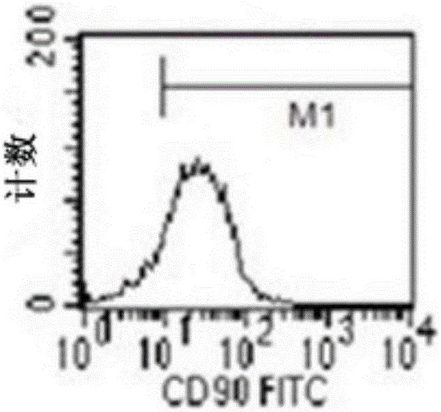 Application of human amniotic mesenchymal stem cells