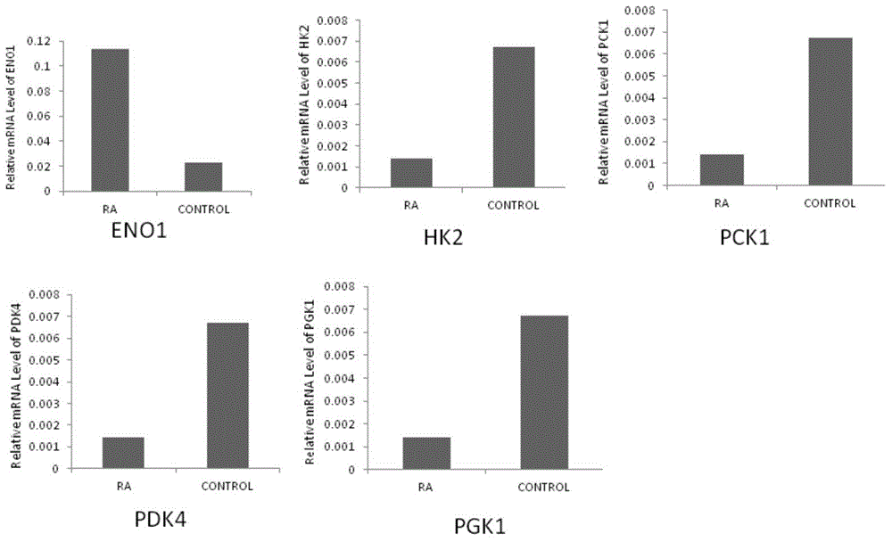 Application of phosphoglycerate kinase 1 to preparation of rheumatoid arthritis diagnosis reagent