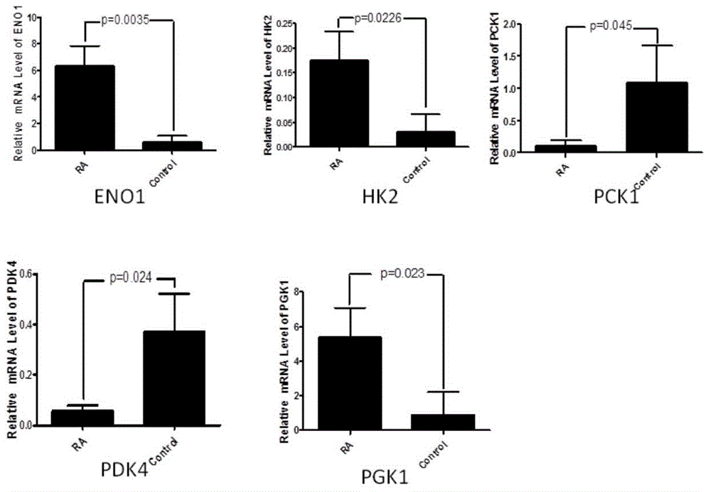 Application of phosphoglycerate kinase 1 to preparation of rheumatoid arthritis diagnosis reagent