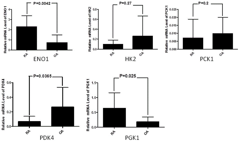 Application of phosphoglycerate kinase 1 to preparation of rheumatoid arthritis diagnosis reagent