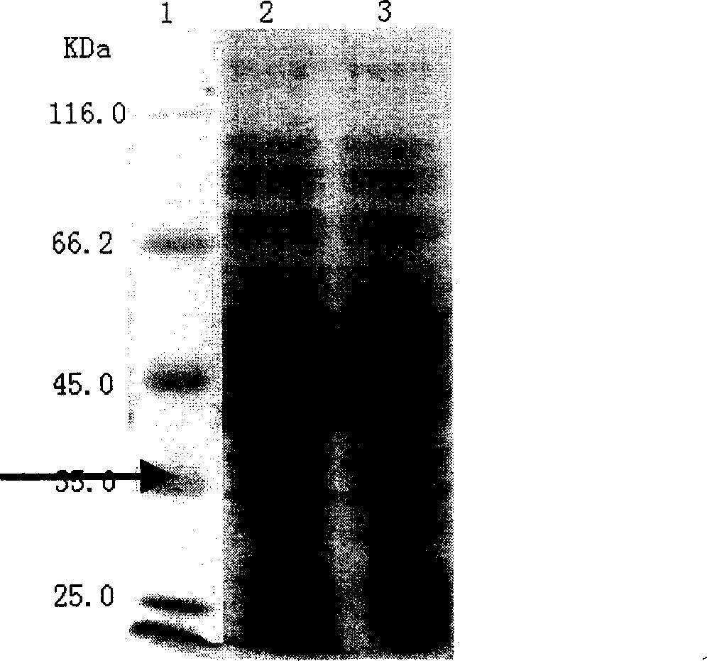 Beta-mannase gene and preparation thereof