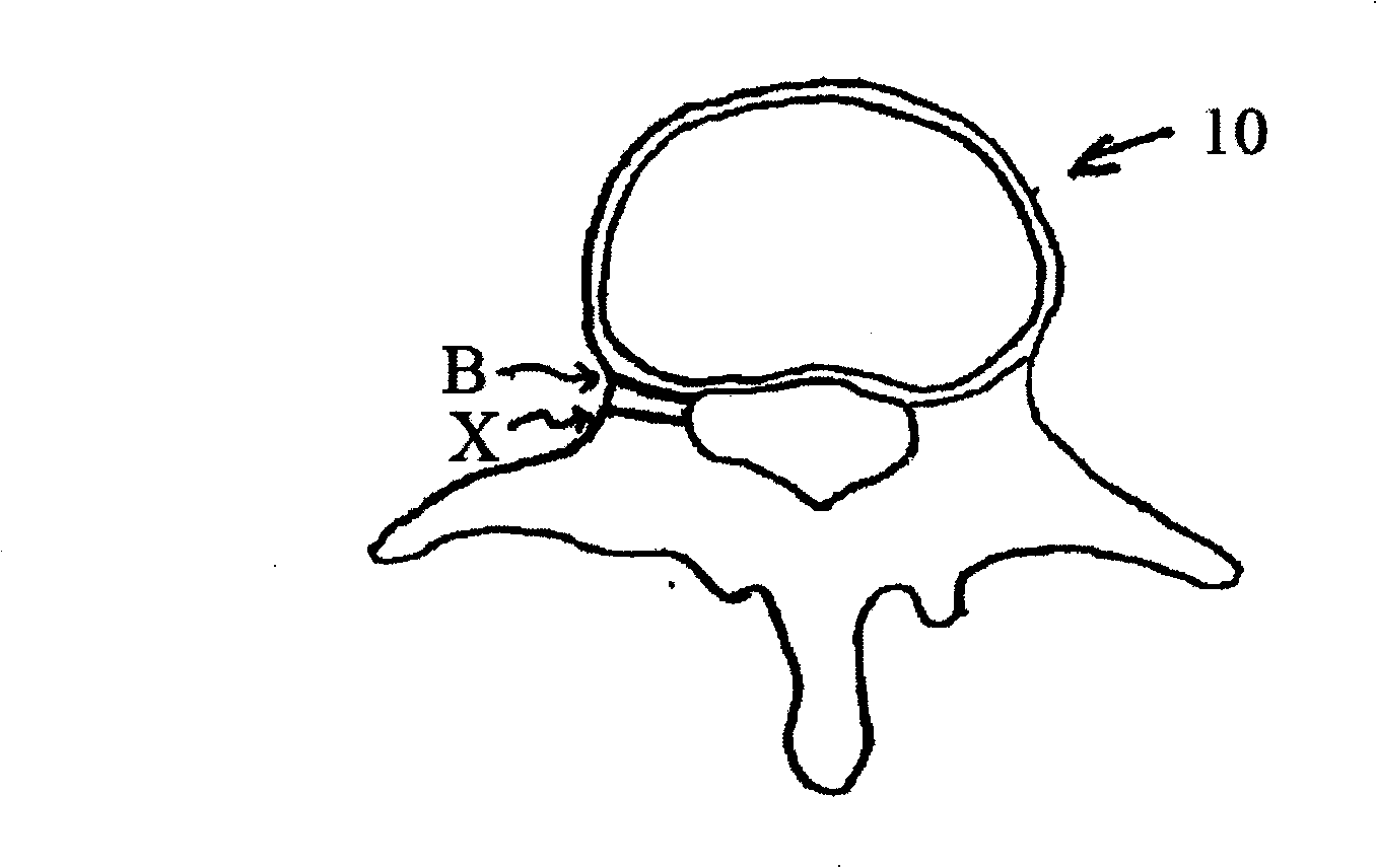 Methods for determining pedicle base circumference, pedicle isthmus and center of the pedicle isthmus