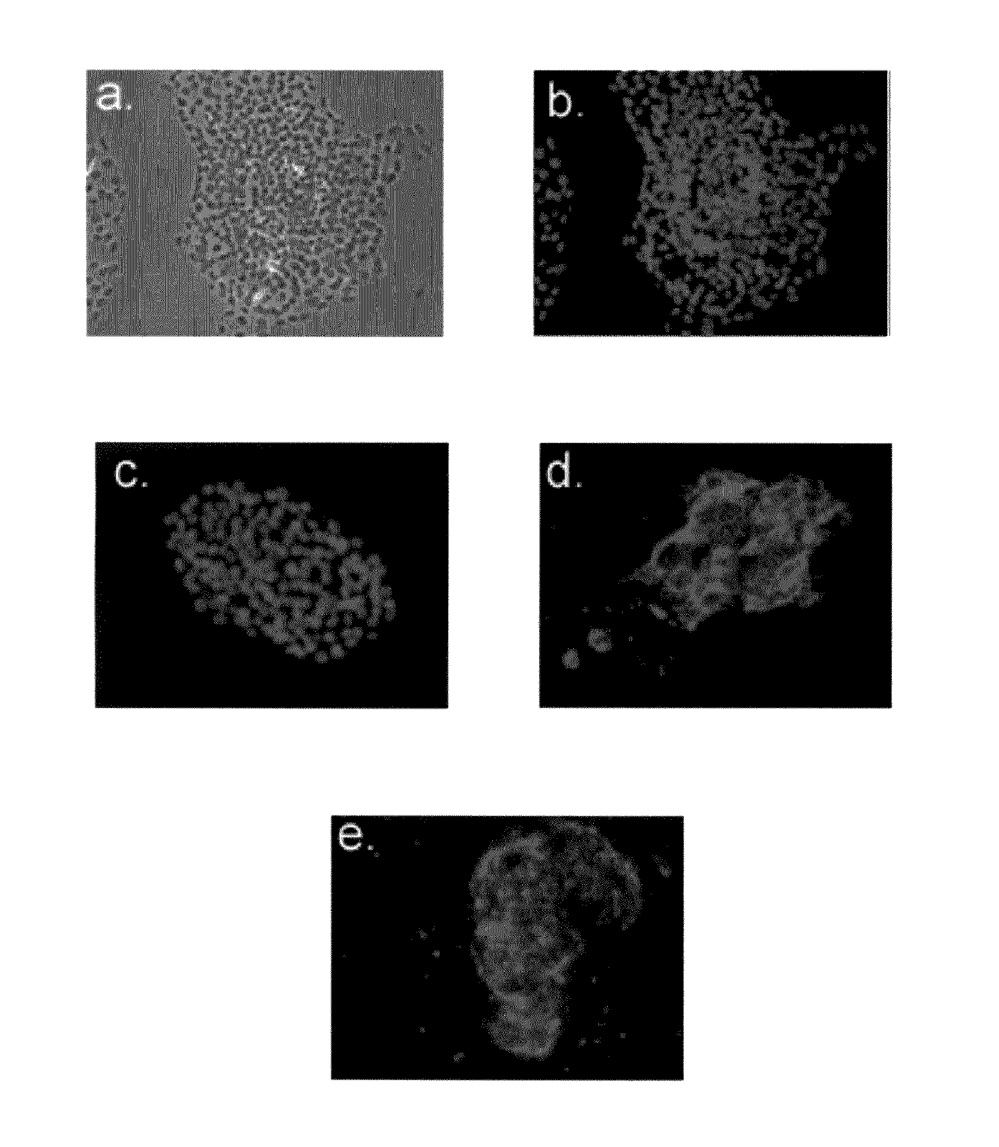 Hemangio colony forming cells and non-engrafting hemangio cells