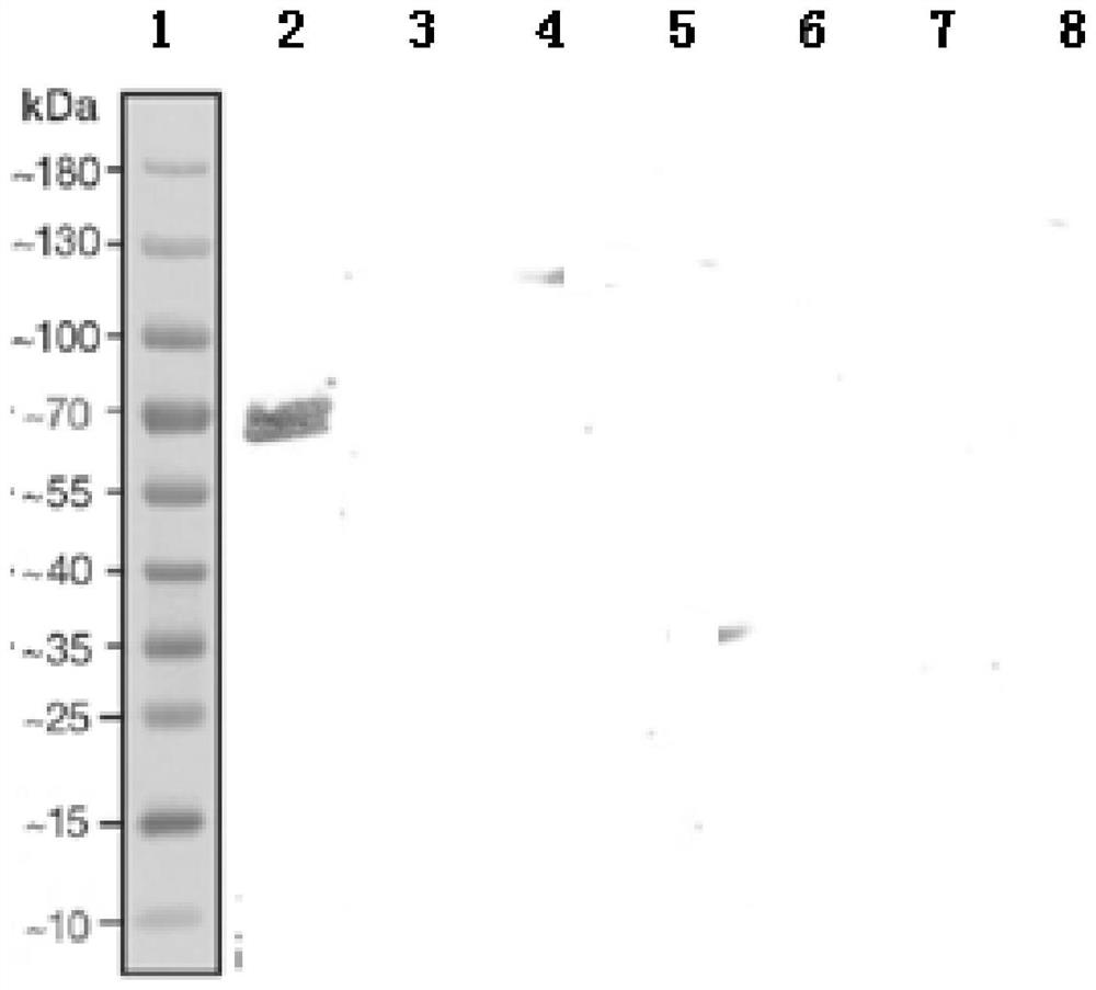 A kind of eukaryotic expressed African swine fever virus p72 antigen and application thereof