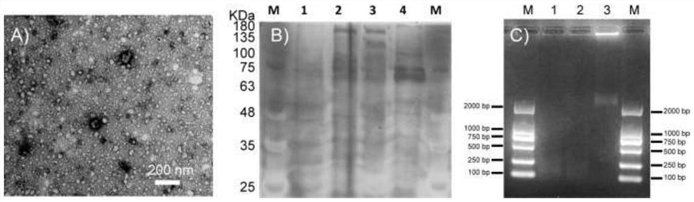 Extracellular vesicle separation and enrichment method based on anionic polymer modified matrix