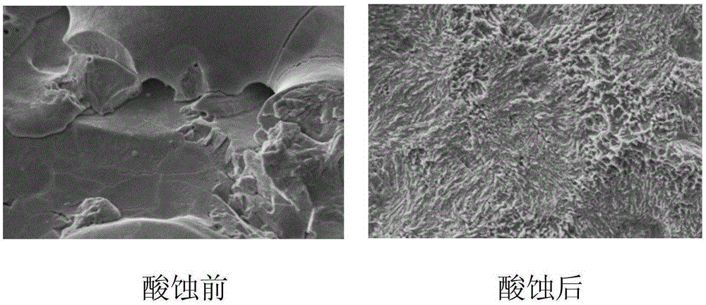 Titanium metal osseointegration implant and titanium metal osseointegration implant surface treatment method