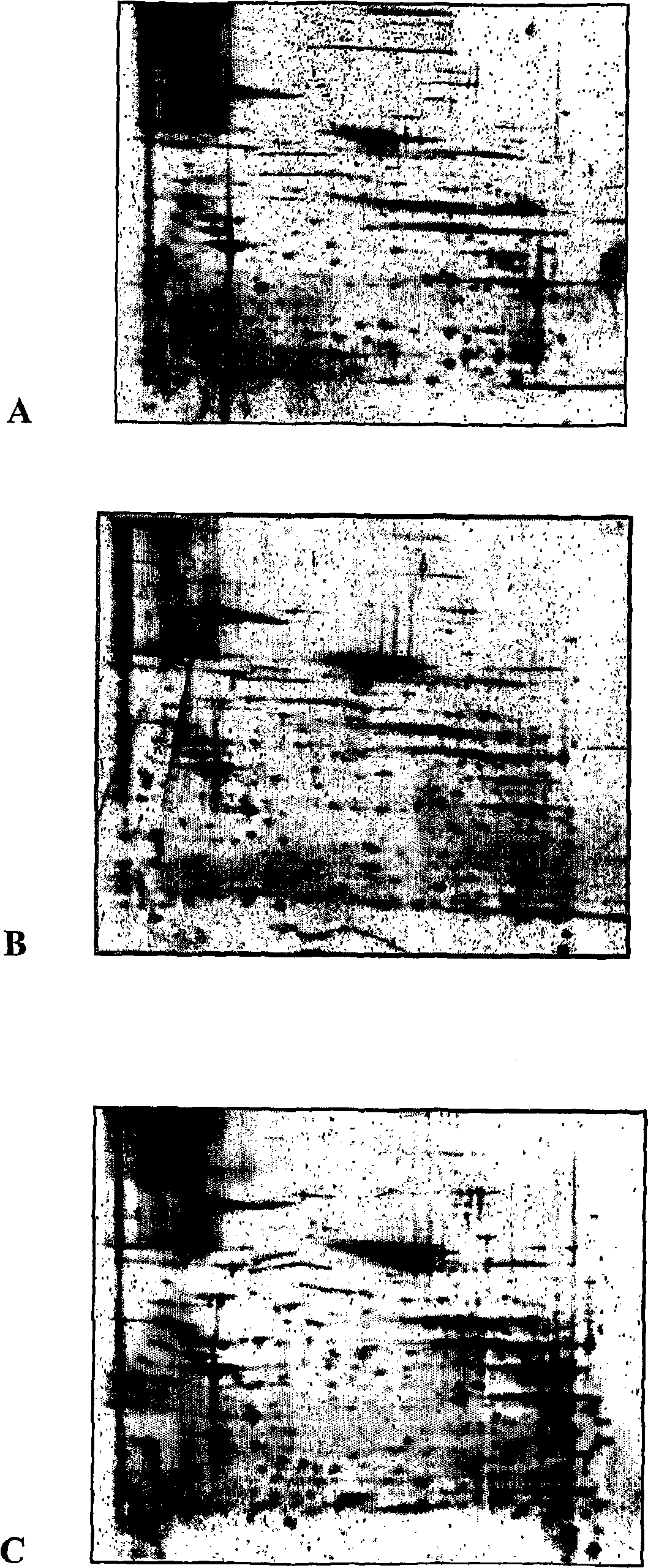 Blood cell separation