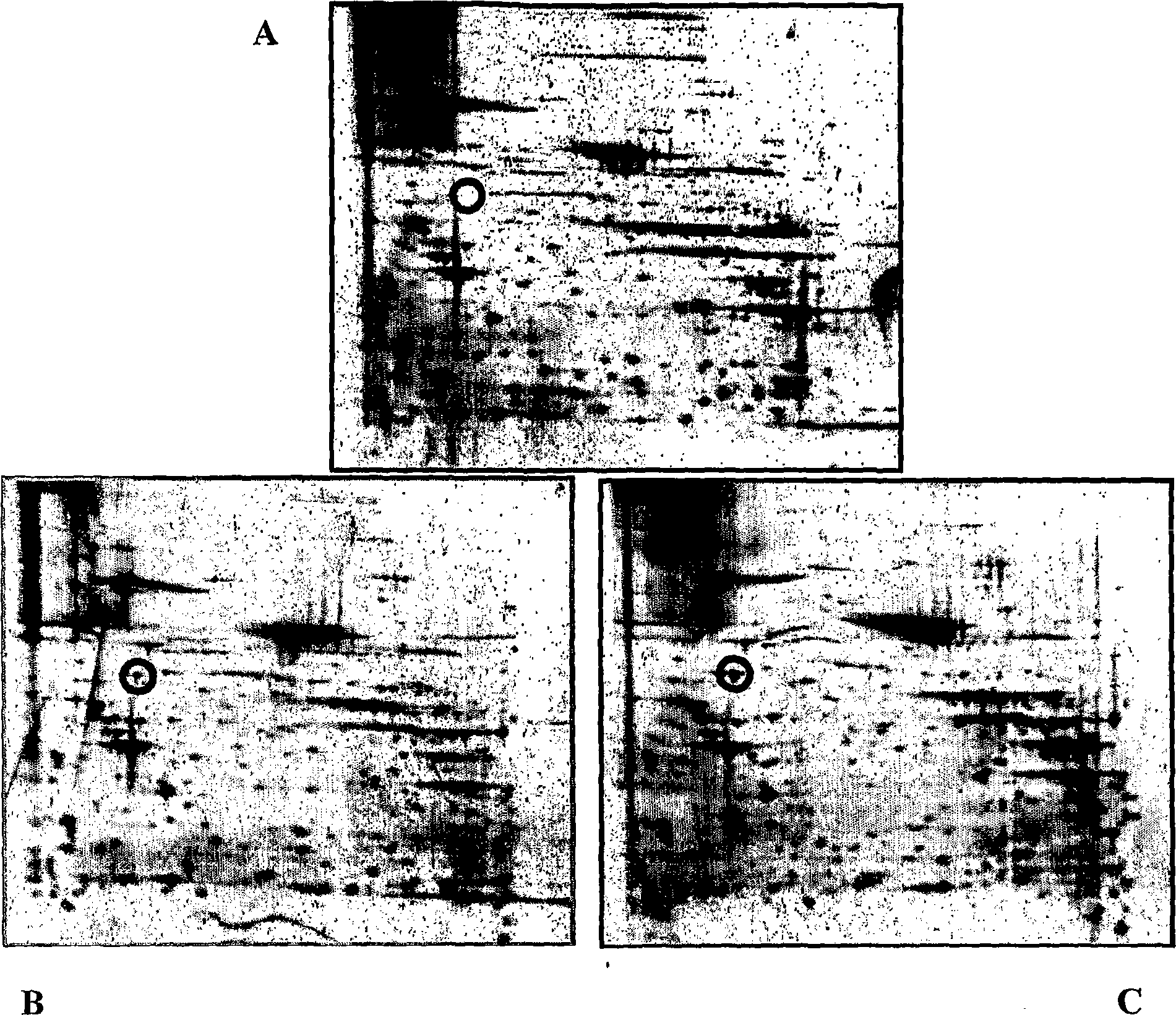 Blood cell separation