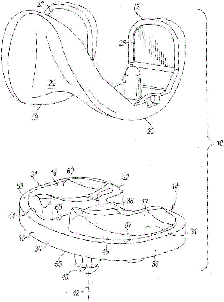 Low profile mobile/fixed prosthetic knee systems