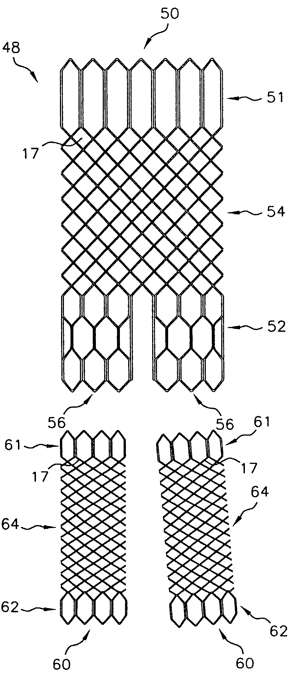 Multi-section filamentary endoluminal stent