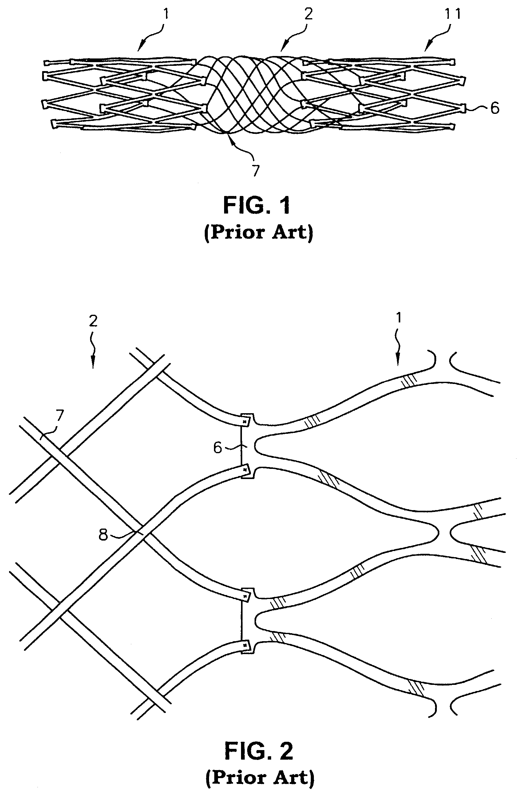 Multi-section filamentary endoluminal stent