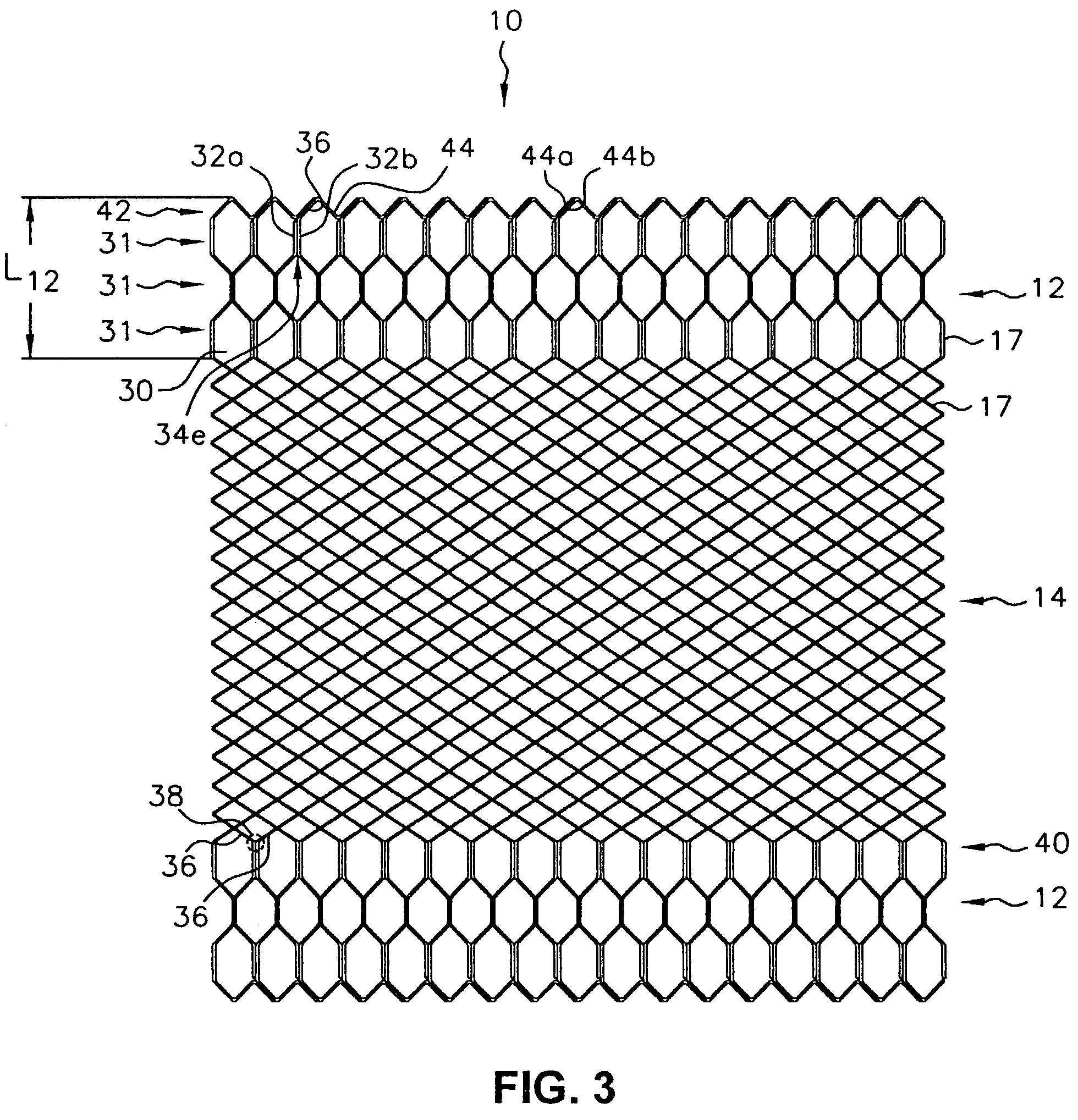 Multi-section filamentary endoluminal stent