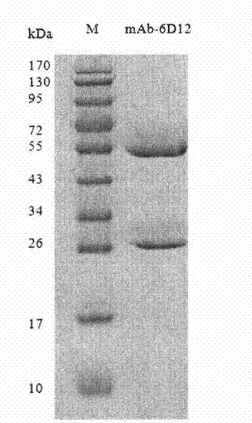 Tetanus toxoid monoclonal antibody and preparation method and application thereof