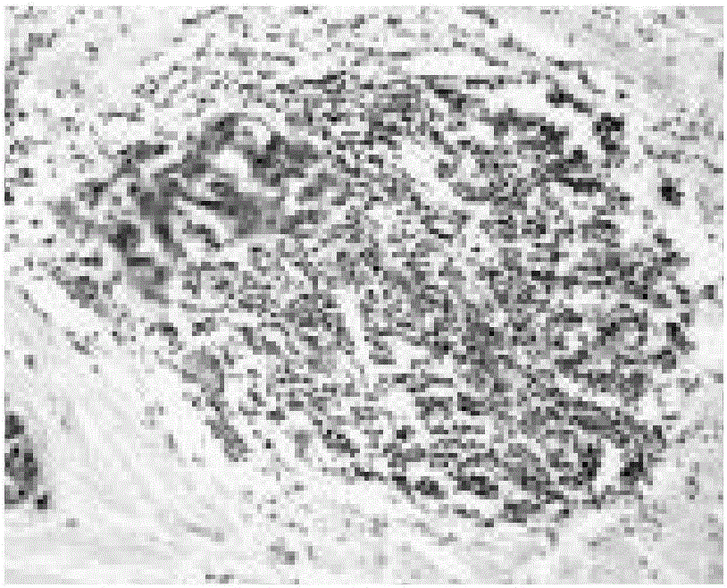 Tumor cell detecting method