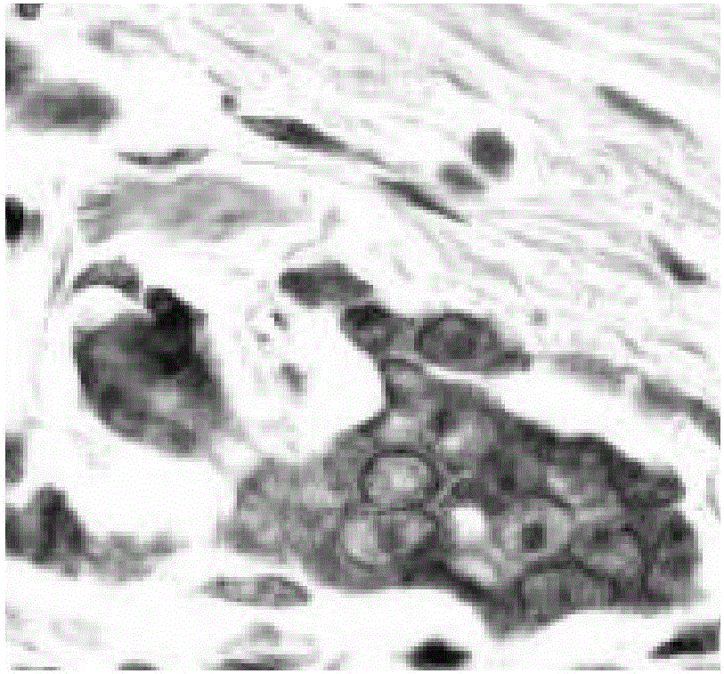 Tumor cell detecting method