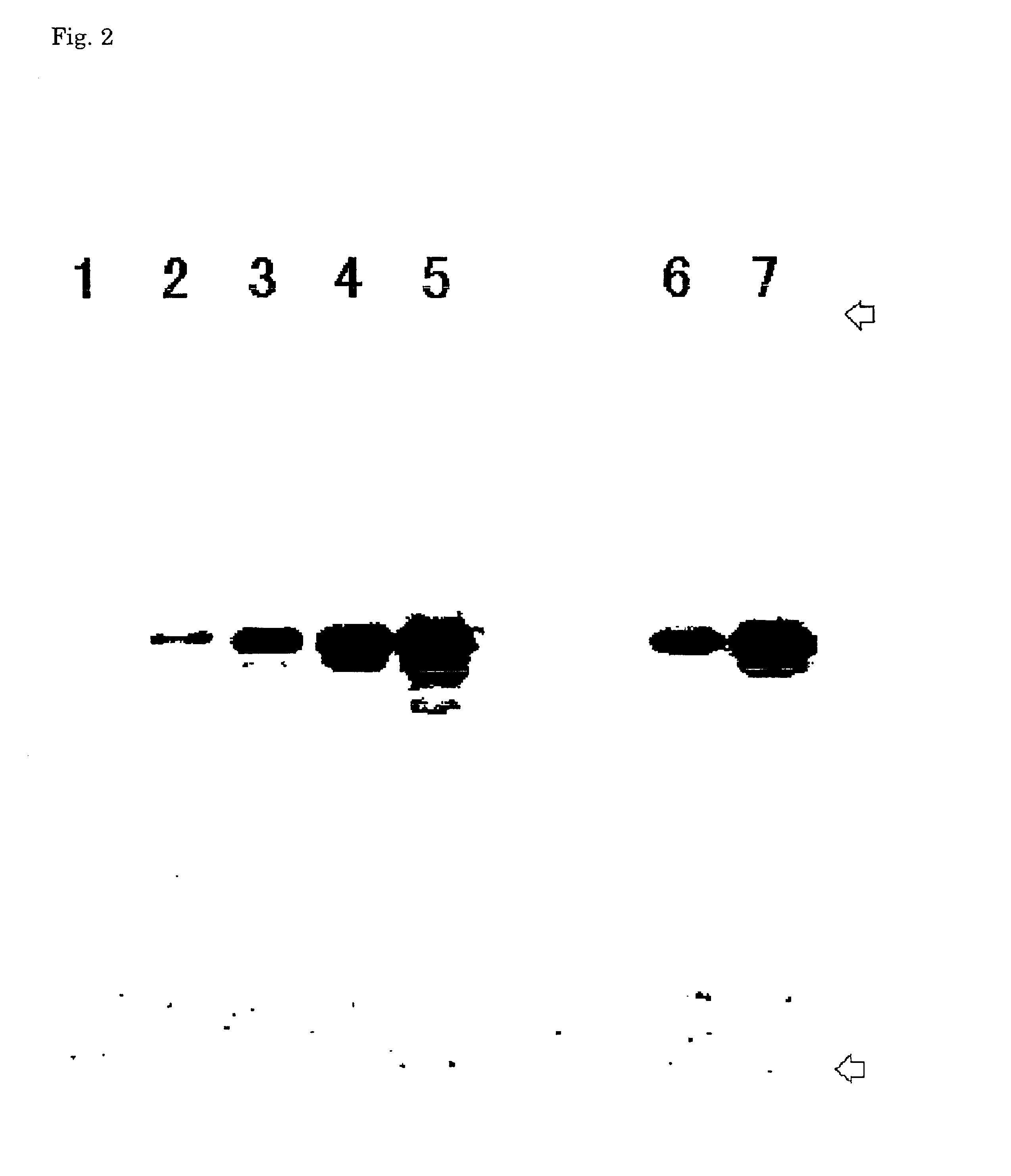 Method for analyzing the amount of intraabdominal adipose tissue