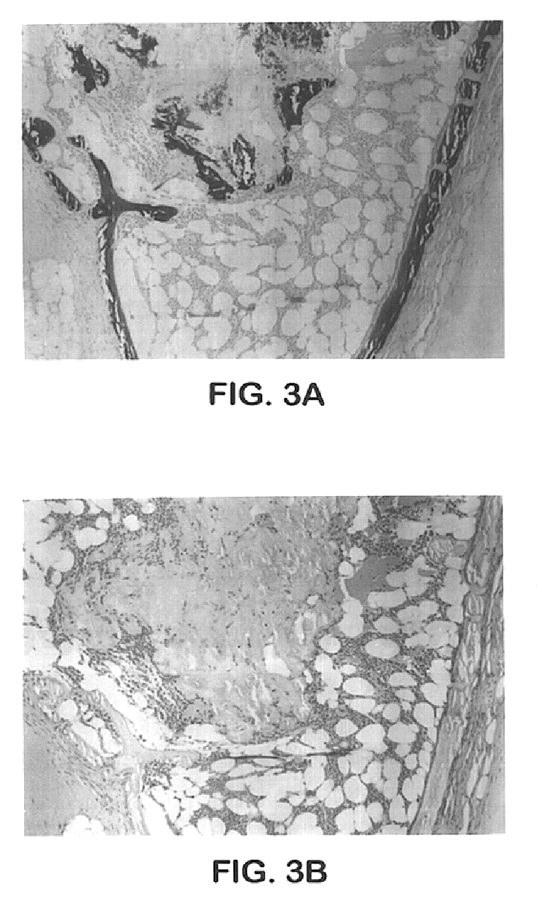 Cartilage/bone inducing materials for reparation