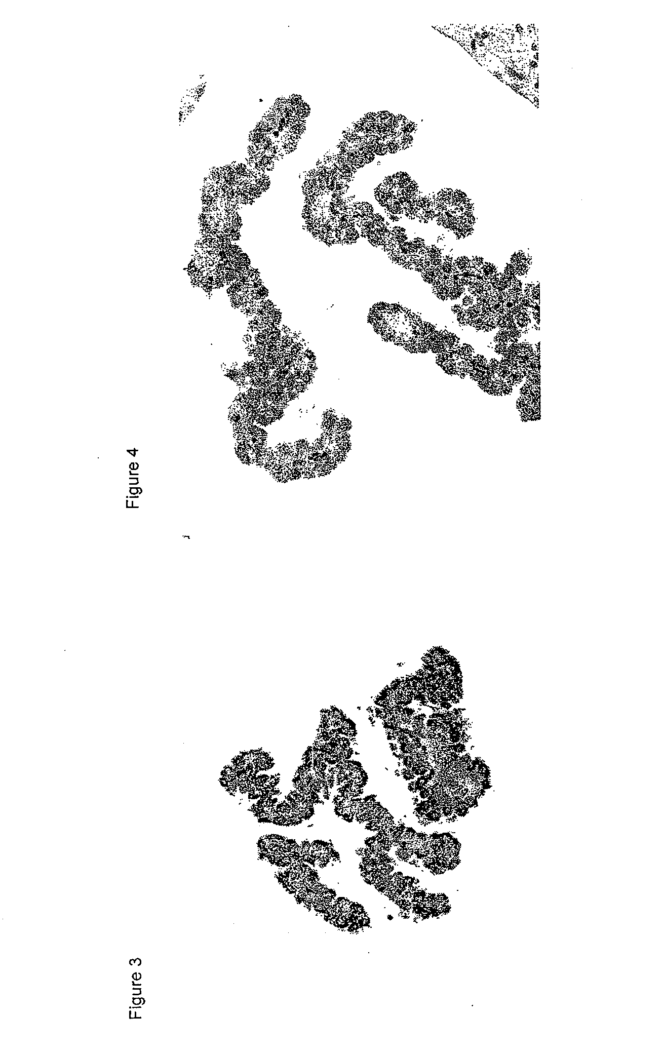 Modulation of transthyretin expression for the treatment of CNS related disorders