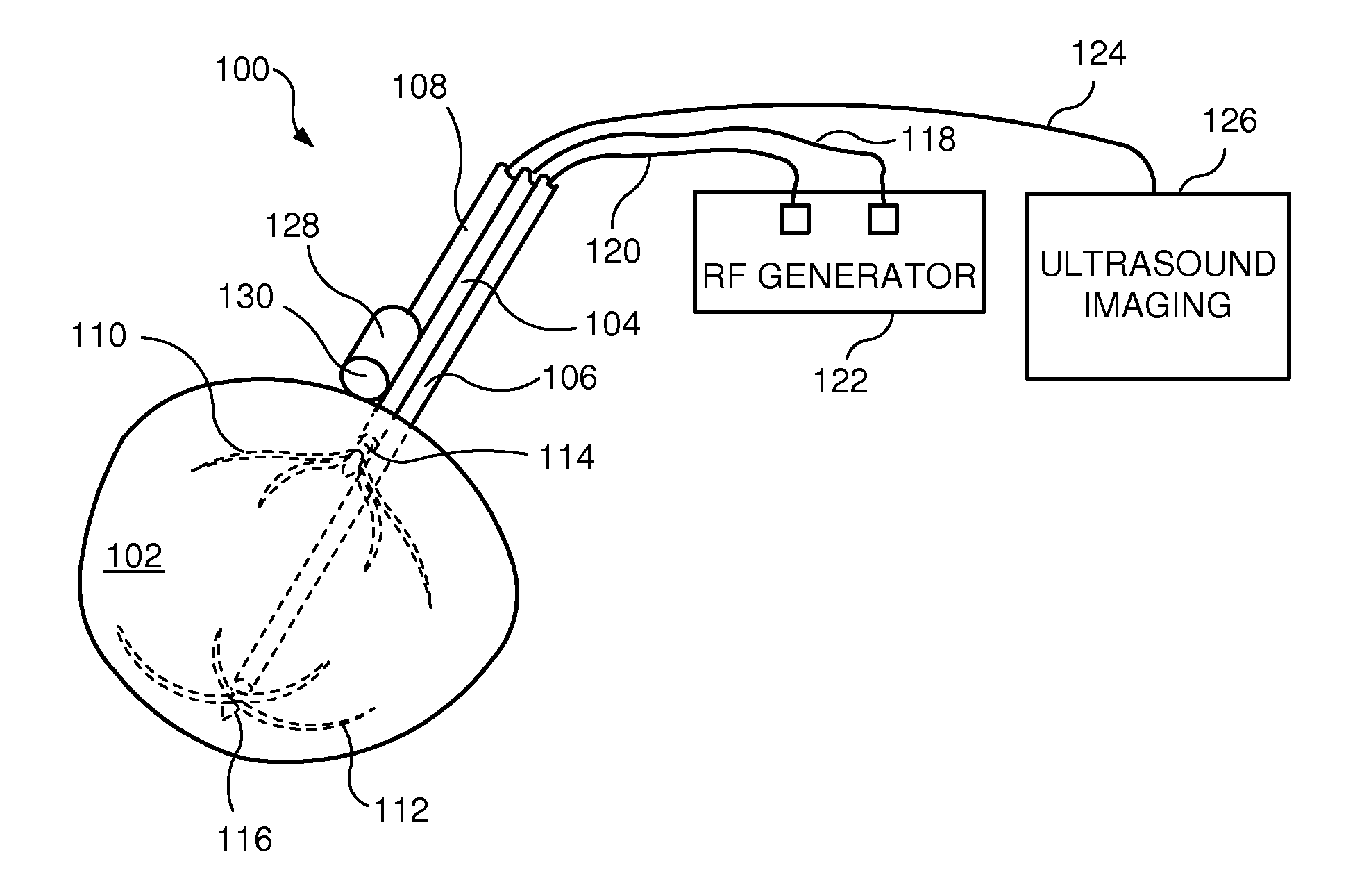 Radio frequency ablation system with integrated ultrasound imaging