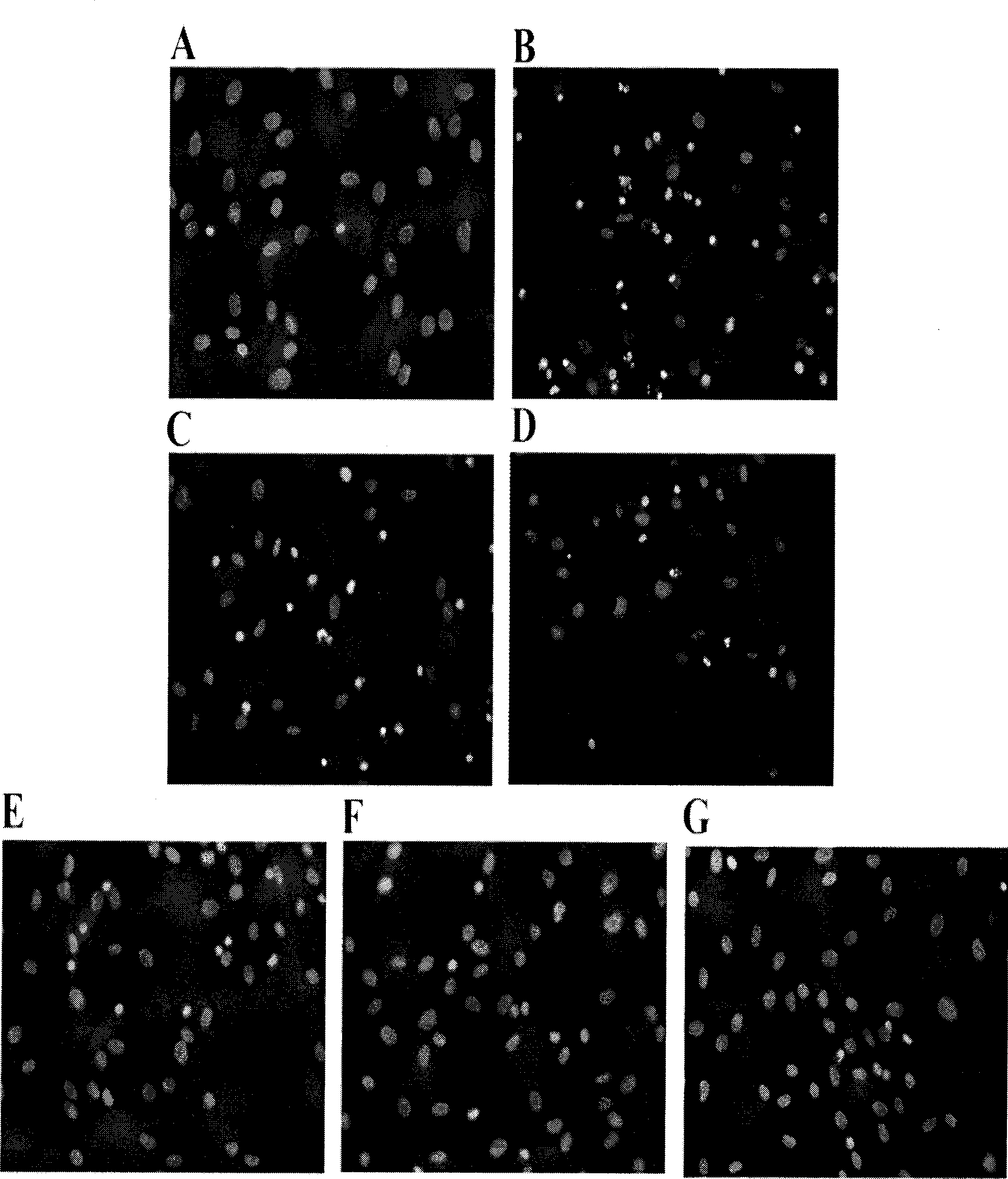 Use of SIP in preparing medicine for preventing mesenchymal stem cells apoptosis