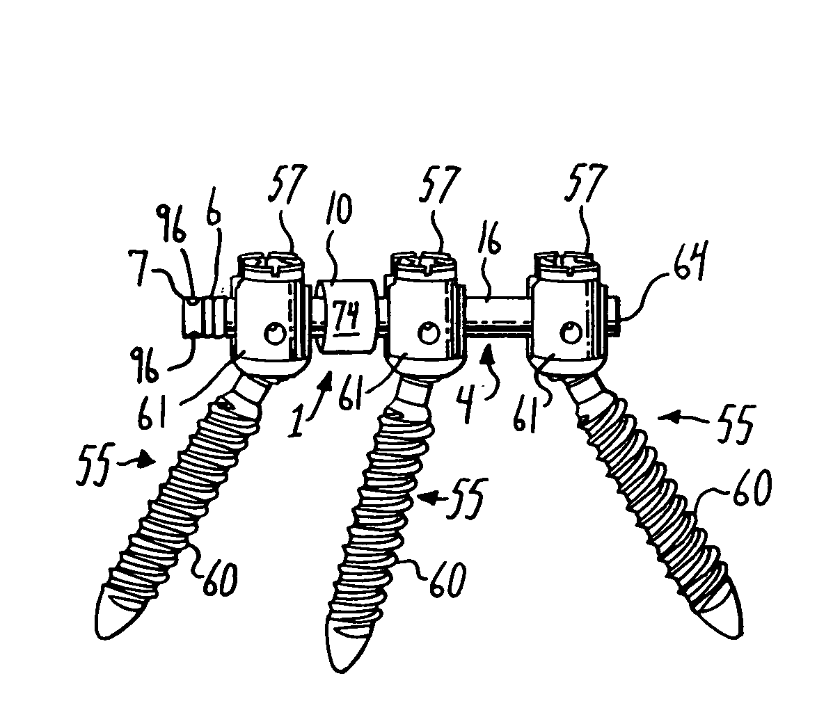 Dynamic stabilization member with fin support and cable core extension