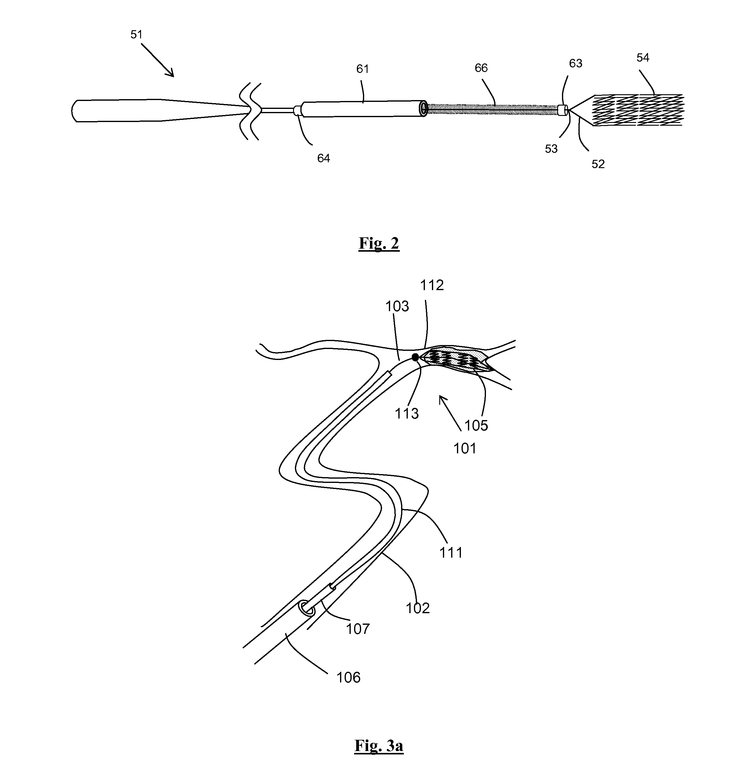 Clot removal device