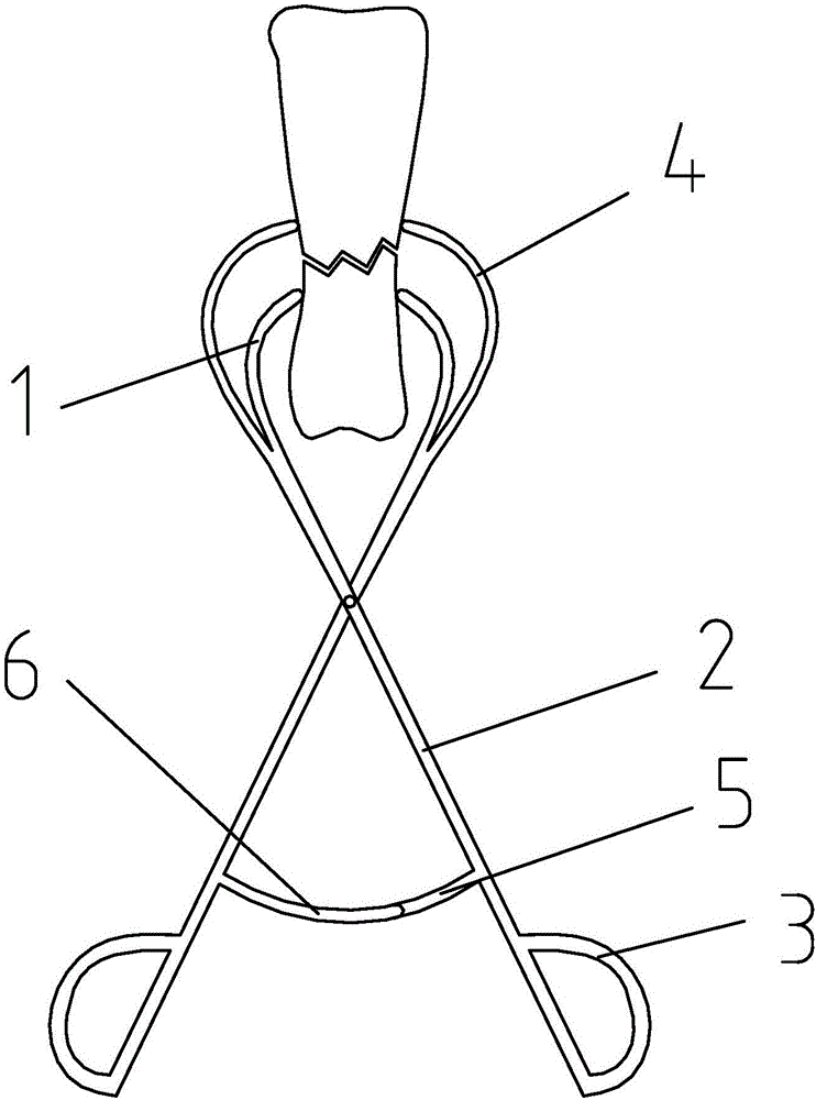 Hand and foot bone fracture reduction holding forceps