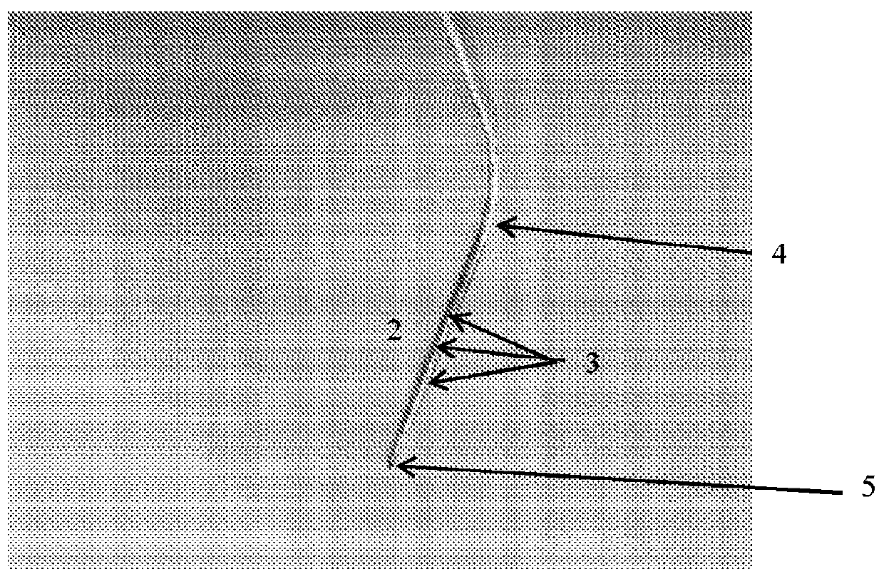 Systems and methods for energy delivery