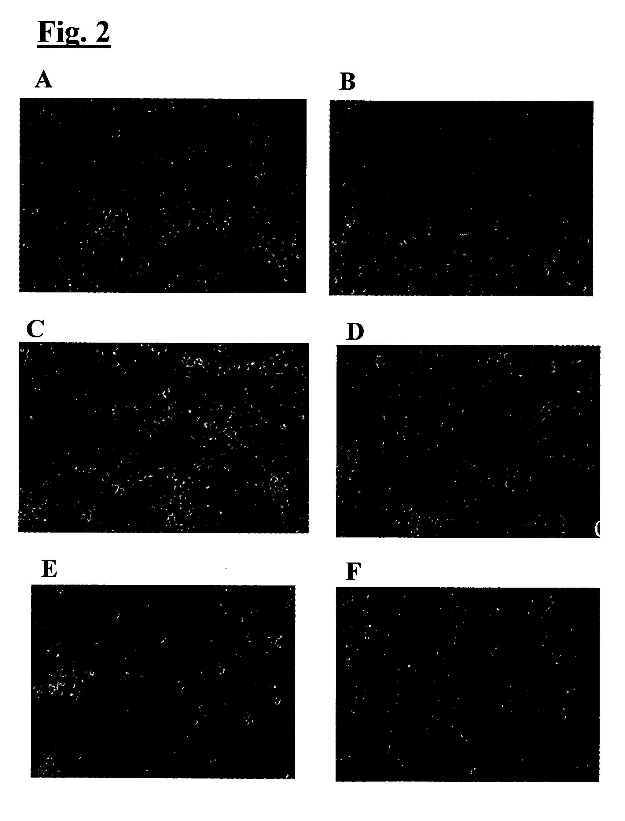 Matrix derived from whole organ