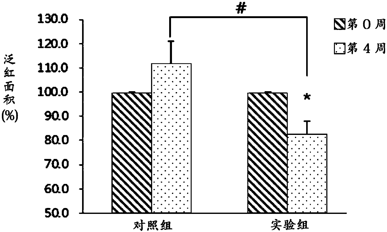 Method for anti-inflammation of skin and promoting keratinocyte proliferation