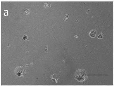 Preparation and conversion method of orchid protoplast and application thereof