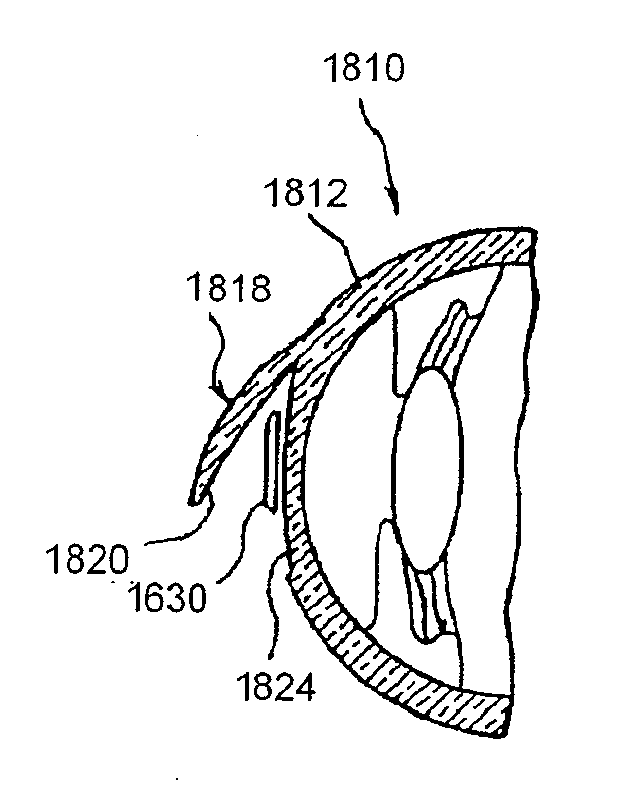 Intrastromal corneal modification