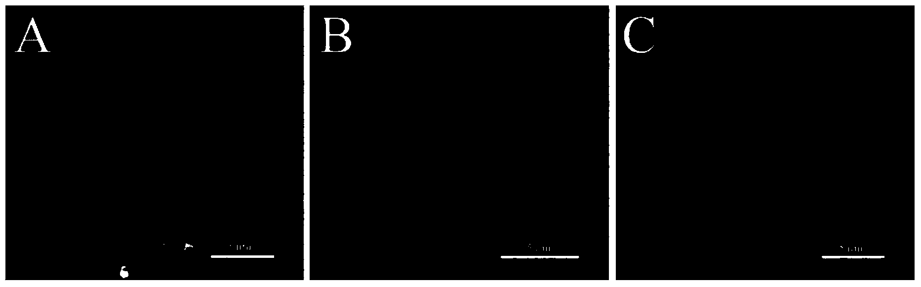 Electrostatic spinning production method for ultrathin porous composite-nanofiber bionic Bruch's film