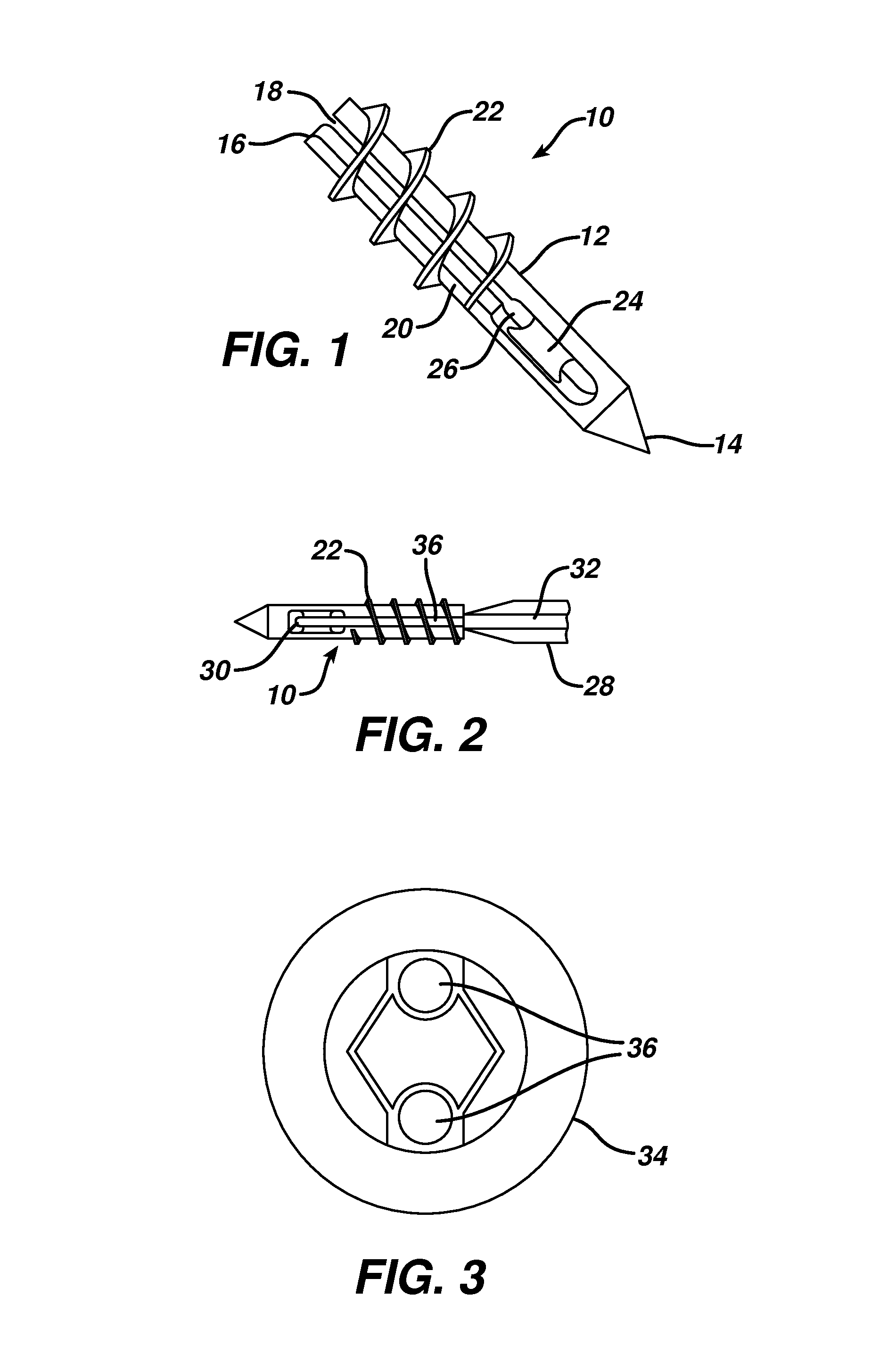 Partial thickness rotator cuff repair system and method