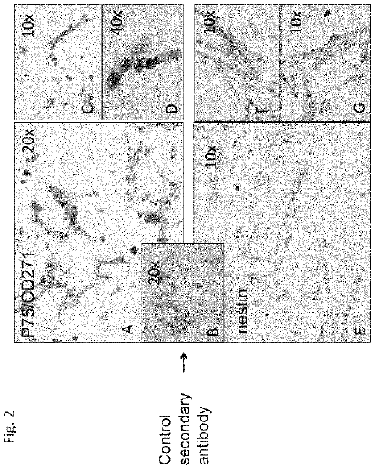 Stem cells expressing mesenchymal and neuronal markers, compositions thereof, and methods of preparation thereof