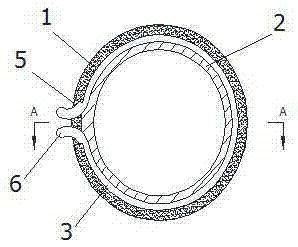 Bionic acetabular prosthesis