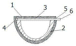 Bionic acetabular prosthesis