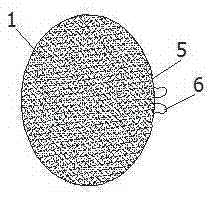 Bionic acetabular prosthesis